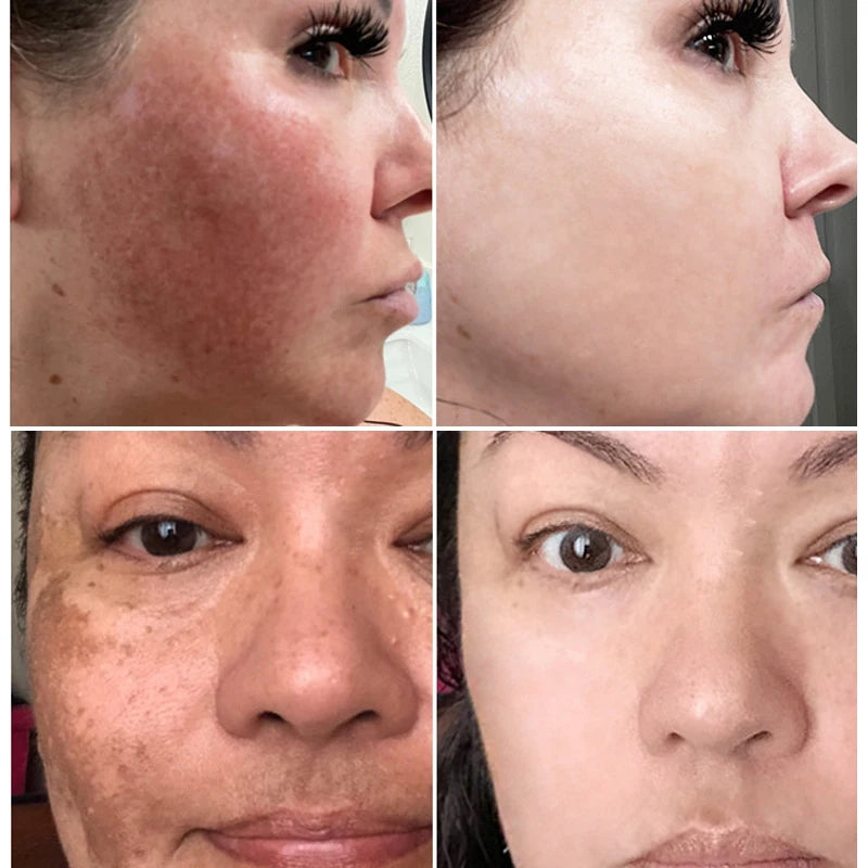 Radiant Glow Skin Serum | Florvae